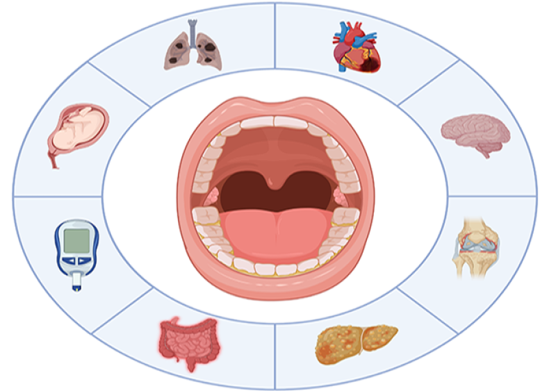 Oral-systemic_2