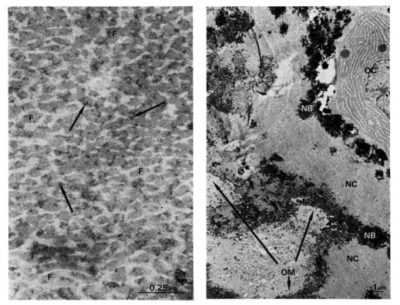 Bone protein image