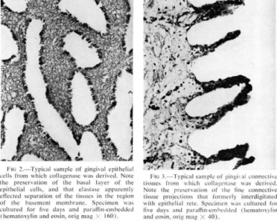 Collagenase Activity image