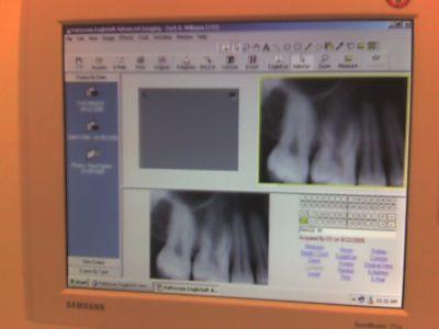 DIGITAL PATIENT RECORDS image