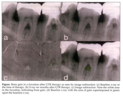 DIGITAL DENTAL XRAY image