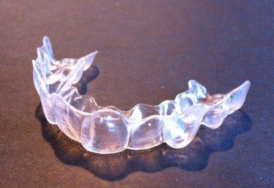 Invisalign picture