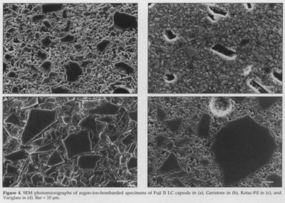 Resin Modified Glass Ionomer Cements image