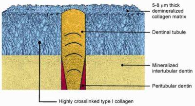 Schematic etch and rinse image